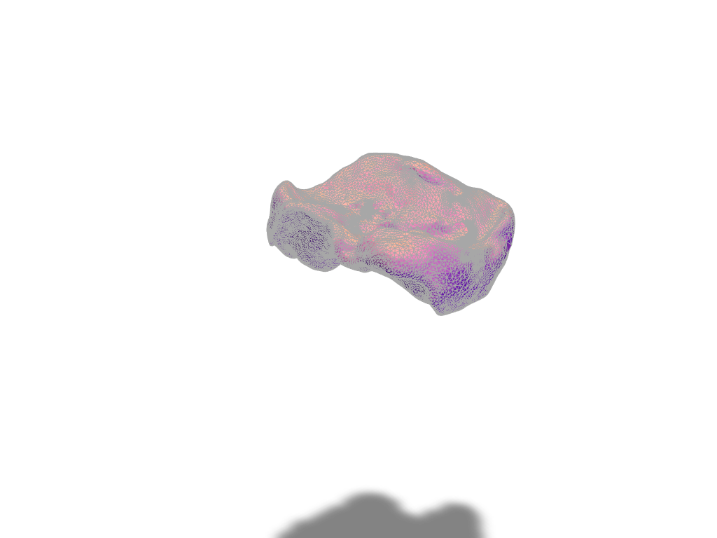 Exocad Inlay - 3D design by Gareth Edward Owen on May 30, 2018 Exocad Inlay - 3D design by Gareth Edward Owen on May 30, 2018